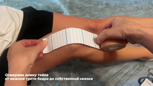 Тейпирование колена при артрозе