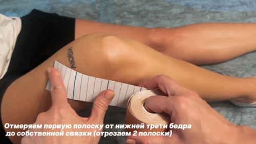 Тейпирование колена бегуна