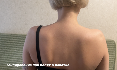 Тейпирование лопатки при боли