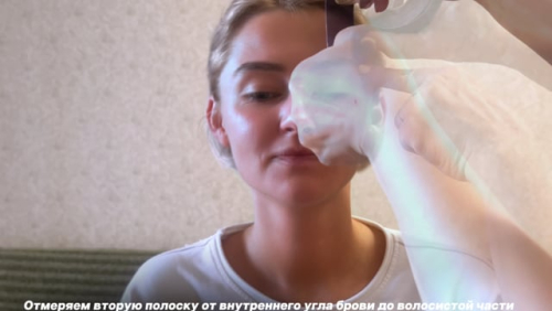 Тейпирование для подтяжки верхнего века